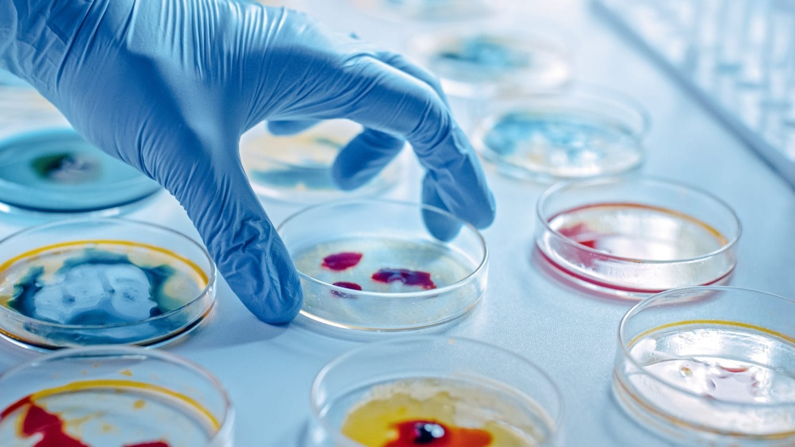 Scientist Works with Petri Dishes with Various Bacteria